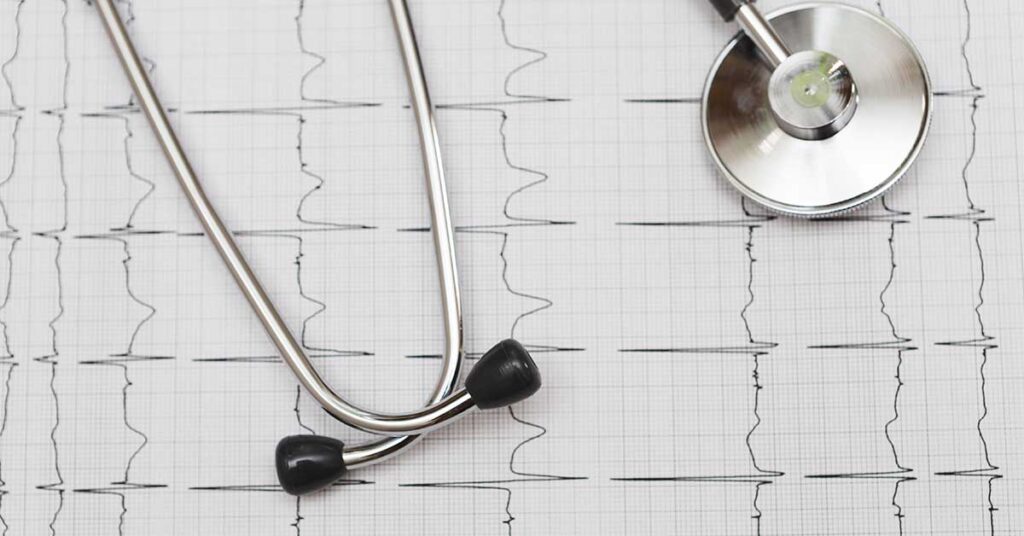 Tratamento da fibrilação atrial: opções e condutas