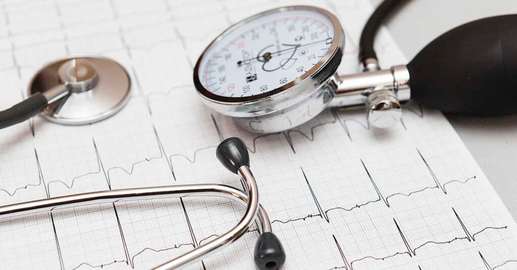 Arritmia Cardíaca: Sintomas e Riscos