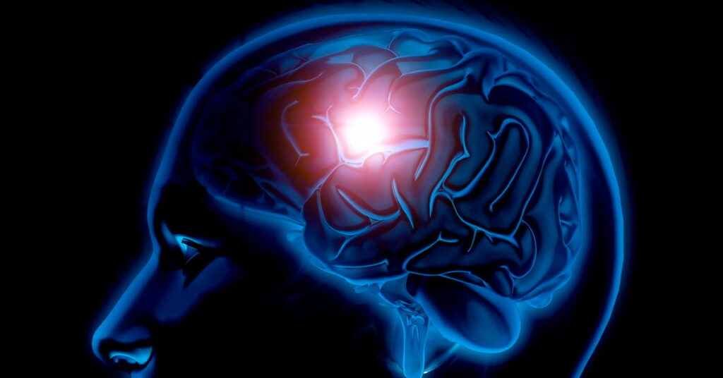 AVC: saiba identificar sintomas rapidamente